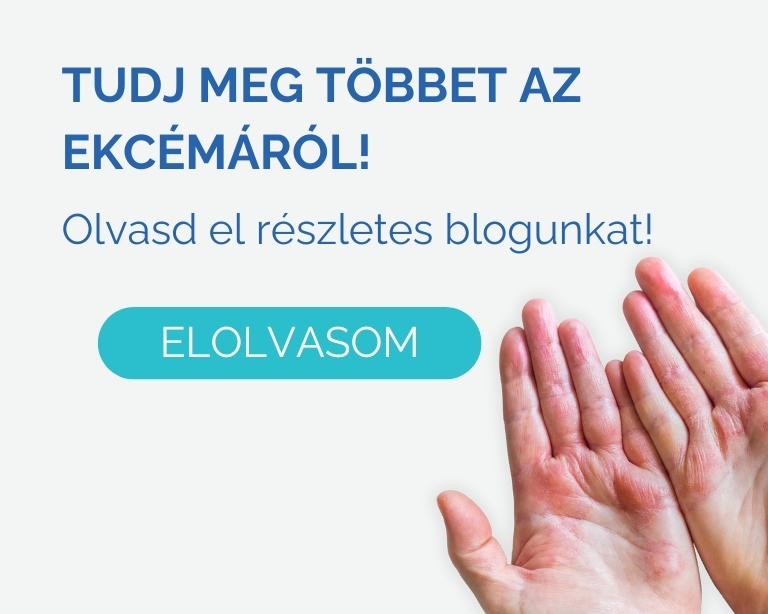 ekcema kezelese