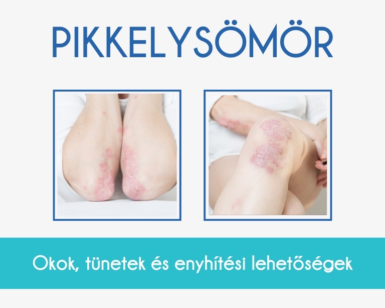 pikkelysömör