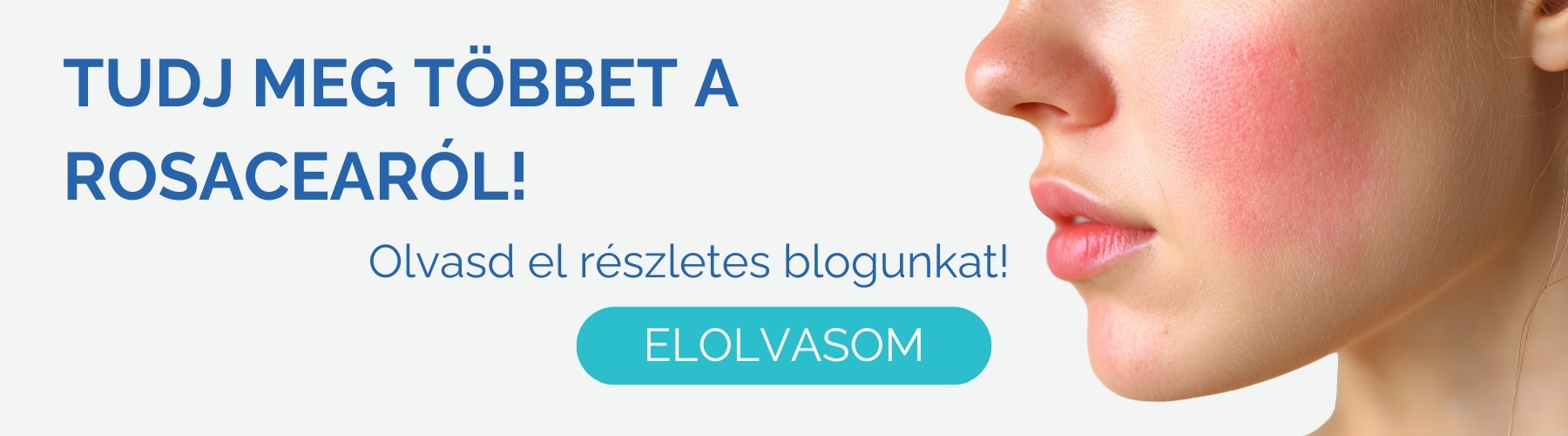 rosacea-kezelese