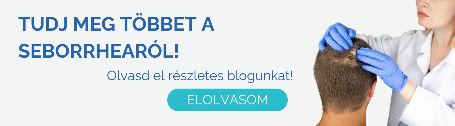 seborrhea_kezelese