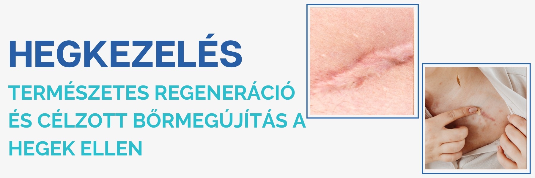 hegek_kezelese