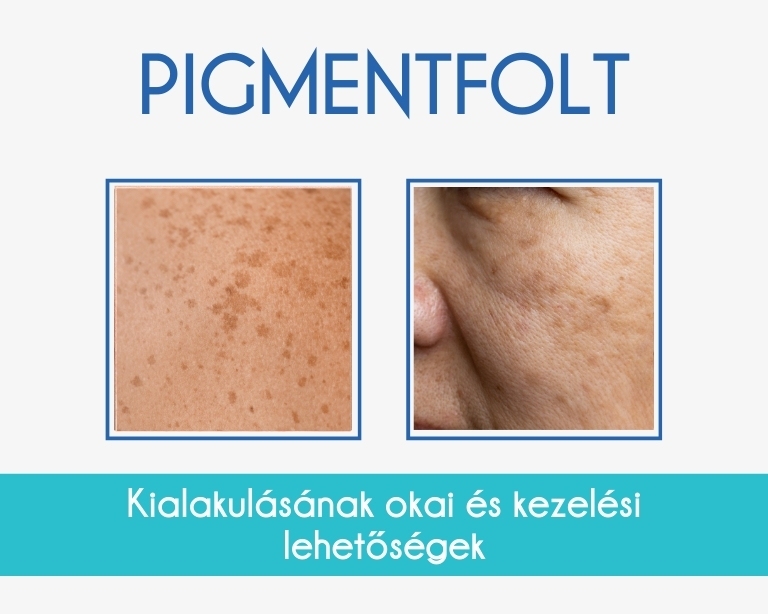 pigmentfolt